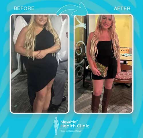 NewMe Health Clinic modern facility in Antalya, Turkey - Gastric sleeve surgery center