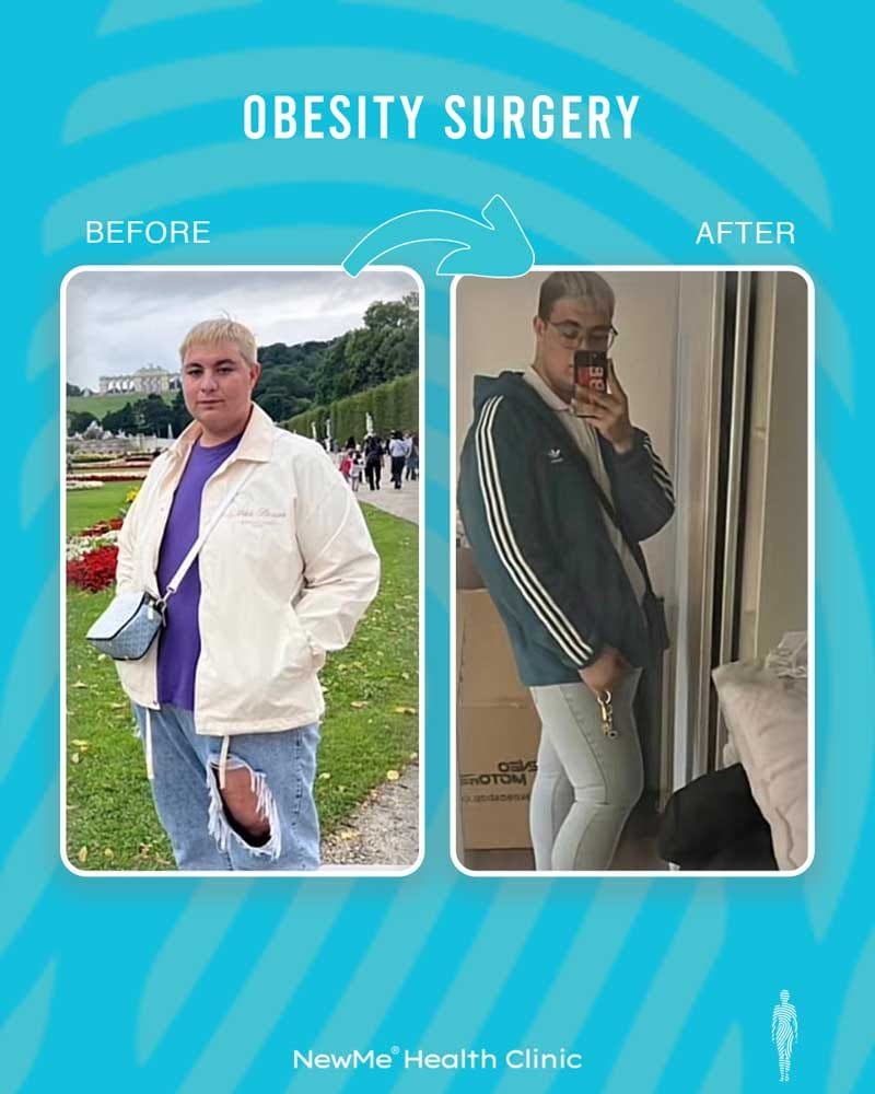 Weight loss transformation — NewMe patient